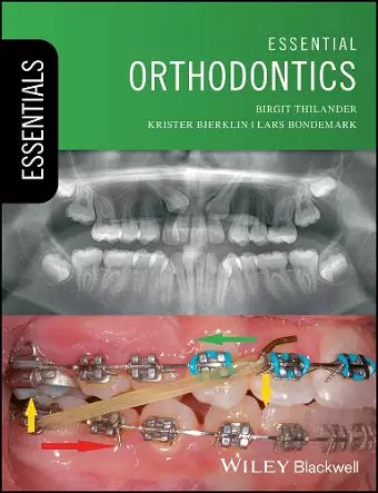 Essential Orthodontics cover