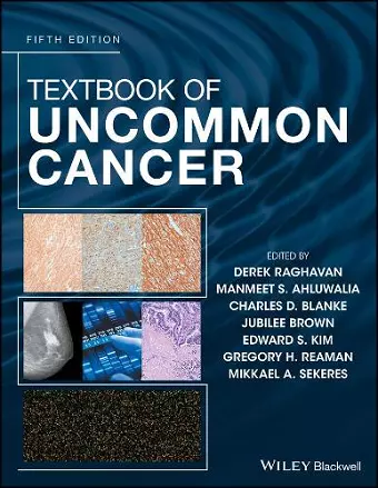 Textbook of Uncommon Cancer cover