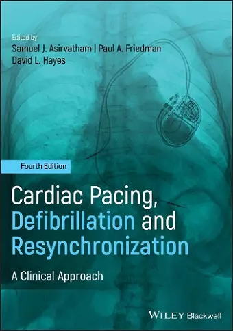 Cardiac Pacing, Defibrillation and Resynchronization cover