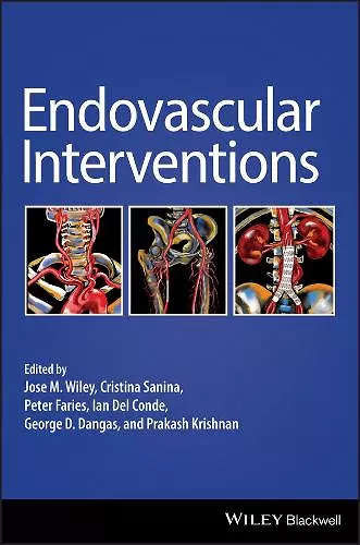 Endovascular Interventions cover