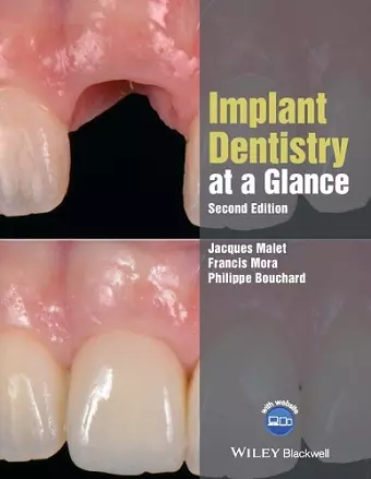 Implant Dentistry at a Glance cover