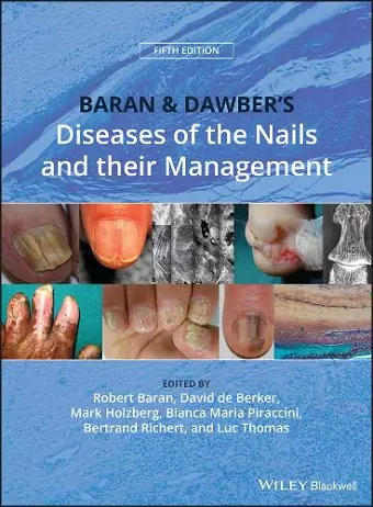 Baran and Dawber's Diseases of the Nails and their Management cover