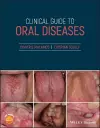 Clinical Guide to Oral Diseases cover