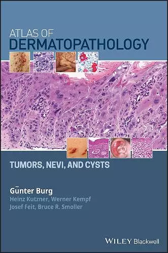 Atlas of Dermatopathology cover