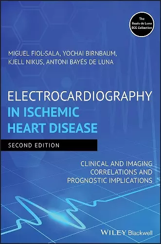 Electrocardiography in Ischemic Heart Disease cover