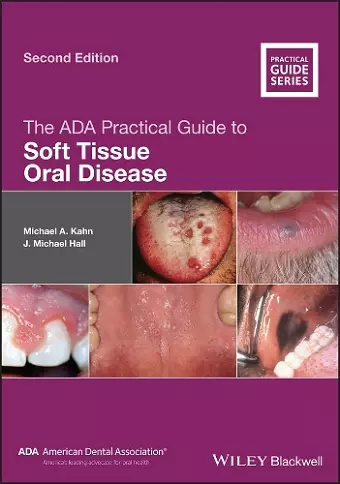 The ADA Practical Guide to Soft Tissue Oral Disease cover