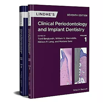 Lindhe's Clinical Periodontology and Implant Dentistry, 2 Volume Set cover