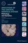 Infections of the Central Nervous System cover