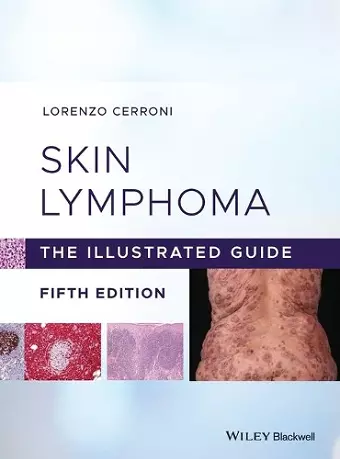 Skin Lymphoma cover