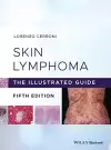 Skin Lymphoma cover