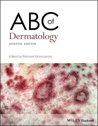 ABC of Dermatology cover