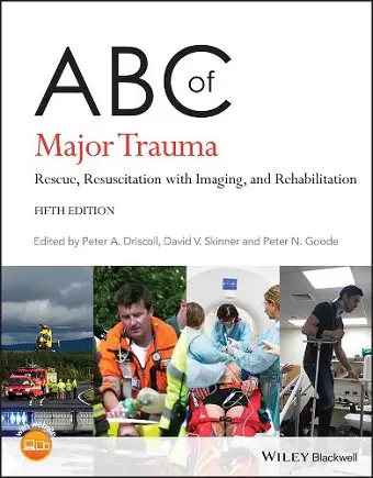 ABC of Major Trauma cover