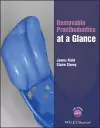 Removable Prosthodontics at a Glance cover