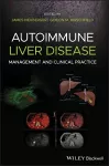 Autoimmune Liver Disease cover