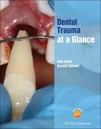 Dental Trauma at a Glance cover