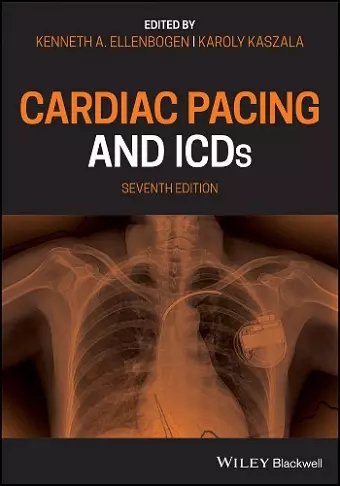 Cardiac Pacing and ICDs cover