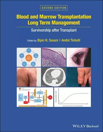 Blood and Marrow Transplantation Long Term Management cover