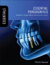 Essential Periodontics cover