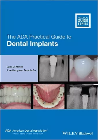 The ADA Practical Guide to Dental Implants cover