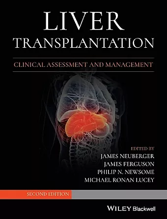 Liver Transplantation cover