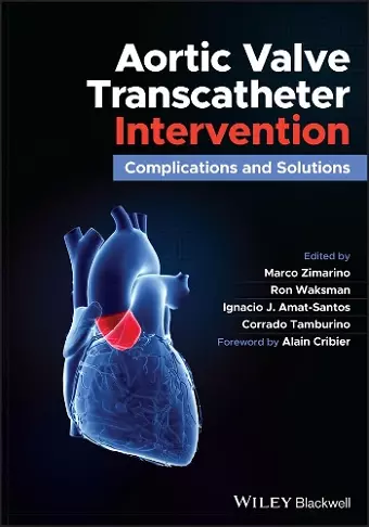 Aortic Valve Transcatheter Intervention cover