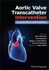 Aortic Valve Transcatheter Intervention cover