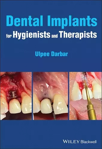 Dental Implants for Hygienists and Therapists cover