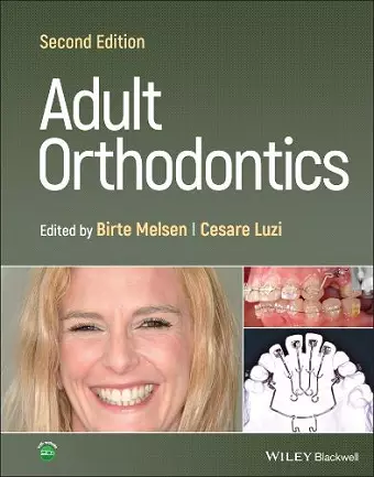 Adult Orthodontics cover