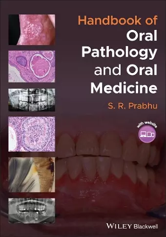Handbook of Oral Pathology and Oral Medicine cover