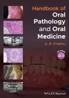 Handbook of Oral Pathology and Oral Medicine cover