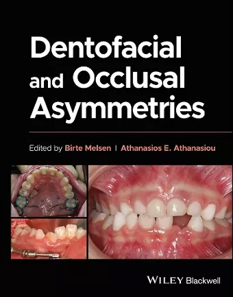 Dentofacial and Occlusal Asymmetries cover