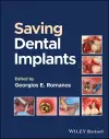 Saving Dental Implants cover