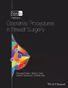 How to Perform Operative Procedures in Breast Surg ery cover