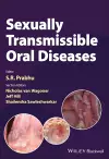 Sexually Transmissible Oral Diseases cover