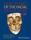 Fractures of the Facial Skeleton cover