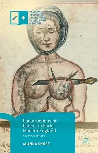 Constructions of Cancer in Early Modern England cover