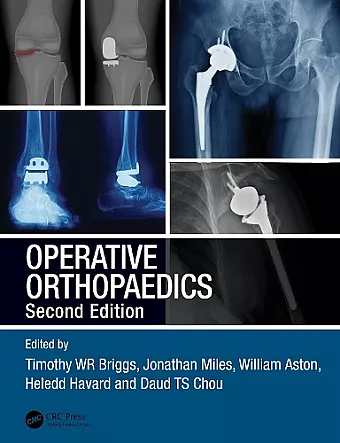 Operative Orthopaedics cover
