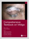 Comprehensive Textbook on Vitiligo cover