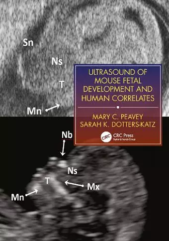 Ultrasound of Mouse Fetal Development and Human Correlates cover