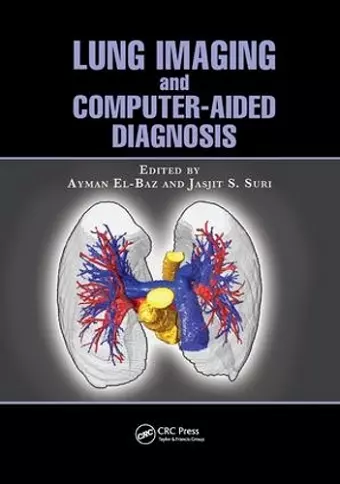 Lung Imaging and Computer Aided Diagnosis cover