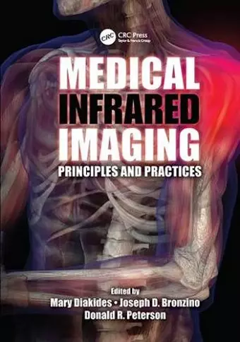 Medical Infrared Imaging cover