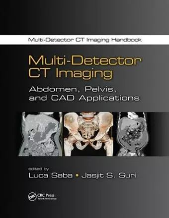 Multi-Detector CT Imaging cover