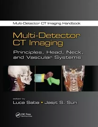 Multi-Detector CT Imaging cover