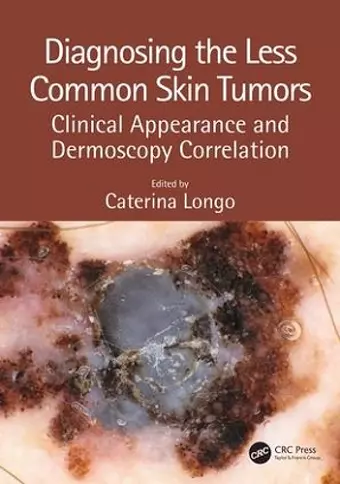 Diagnosing the Less Common Skin Tumors cover