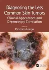 Diagnosing the Less Common Skin Tumors cover