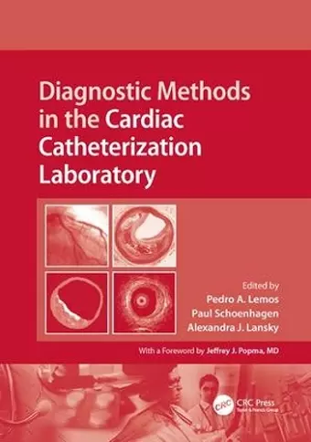 Diagnostic Methods in the Cardiac Catheterization Laboratory cover