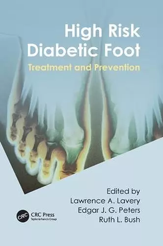 High Risk Diabetic Foot cover