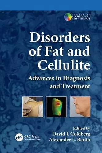 Disorders of Fat and Cellulite cover