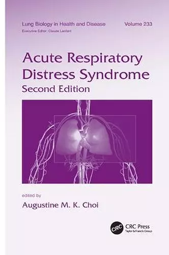 Acute Respiratory Distress Syndrome cover