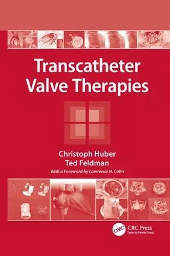 Transcatheter Valve Therapies cover